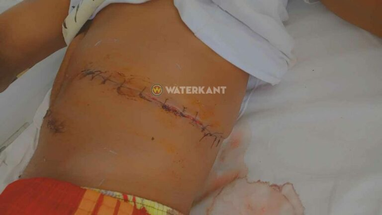 «Tres guyaneses son arrestados en el caso de la apertura del abdomen a un joven.»